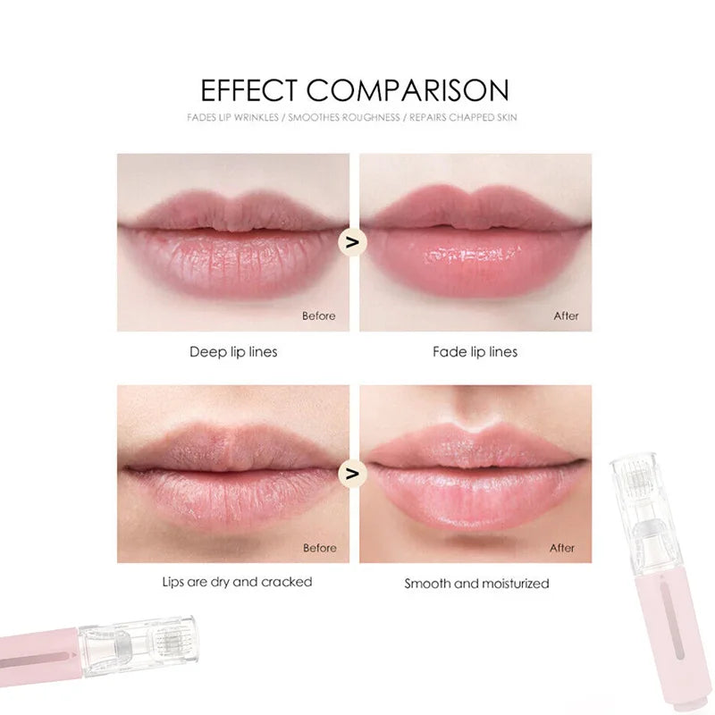 Derma Roller Beard Growth Lip Treatment  Serum - IRON GODDESS
