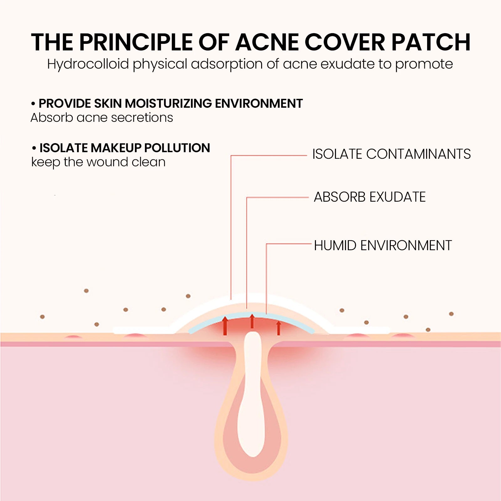 Gentle Waterproof Pimple Patches Deep Clean Acne Eraser - IRON GODDESS