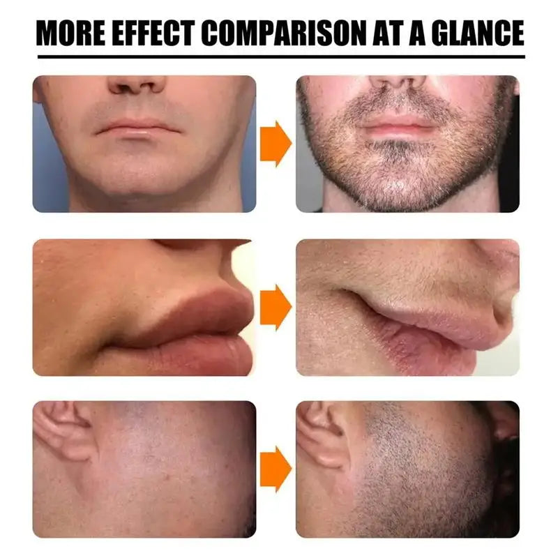 Fast Eyelash Growth Serum 5 Days Natural Eyelash Enhancer Longer Fuller Thicker Lashes Treatment New Products Eye Care Makeup ﻿ - IRON GODDESS