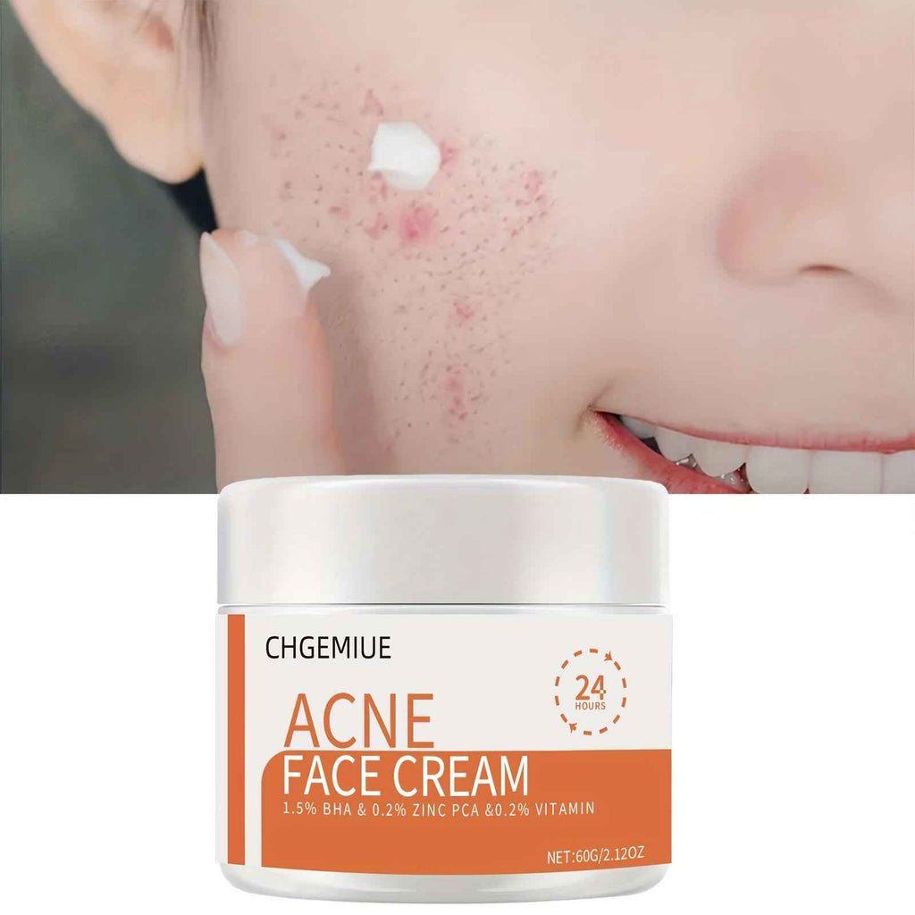 CHGEMIUE Salicylic Acid Face Cream, Moisturizing & Balancing, Gentle Cleansing for All Light Beige Types, Alcohol-Free, Unisex Skincare with Zinc PCA & Vitamin E, Light Beige Care, Daily Facial Care, Sleek Jar Design, Alcoholfree Formula